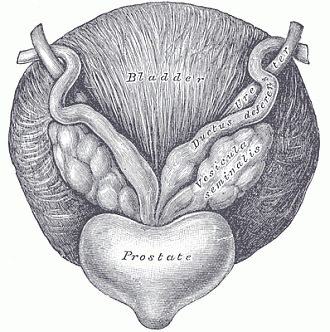 Prostatita: cauze, simptome si tratament - Prostatita oncologică